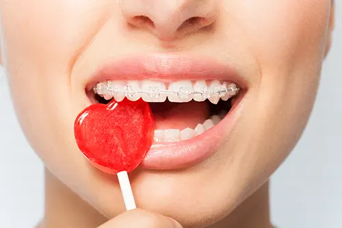 Oyster Point Dental - Eating Candy While Wearing Braces
